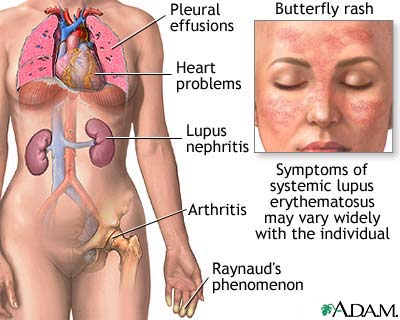 Stress Rashes Pictures. stress) and hormonal