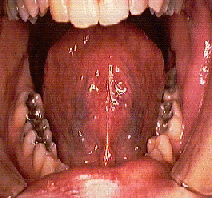 mouthlive.gif (36891 bytes)