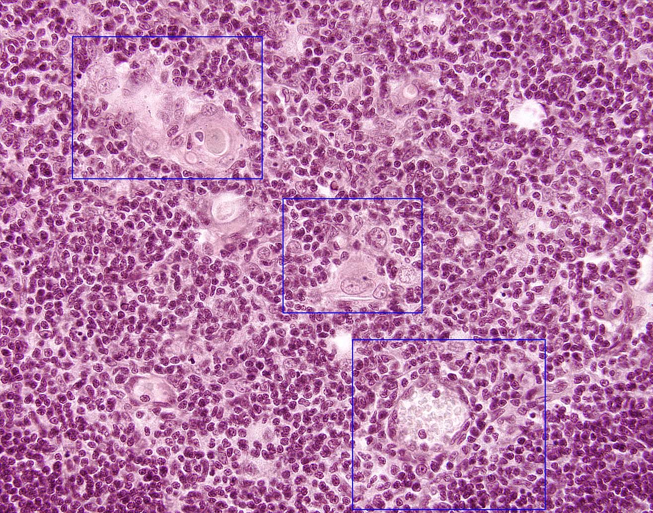 Thymic Medula at 400X Magnification