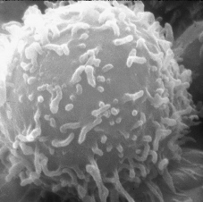 Electron microscope scan of a lymphocyte